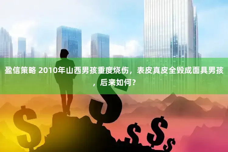 盈信策略 2010年山西男孩重度烧伤，表皮真皮全毁成面具男孩，后来如何？